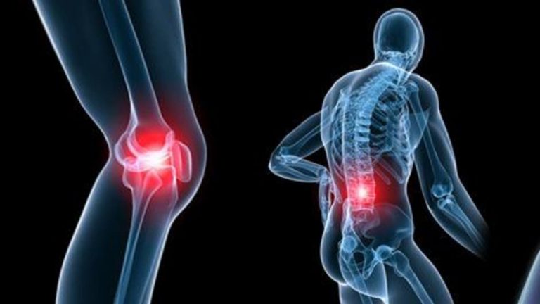 السكريات والألبان.. تجنّبها بحال الاصابة بالتهابات المفاصل