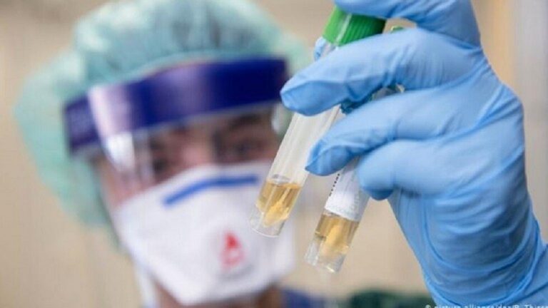 12 حالة وفاة جديدة بكورونا..ماذا عن الاصابات؟