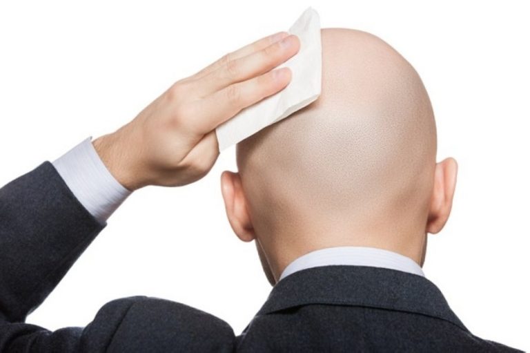 الرجل الأصلع أكثر نضجا من غيره!