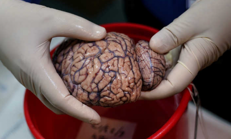 7 طرق يؤثر بها فيروس كورونا على الدماغ!