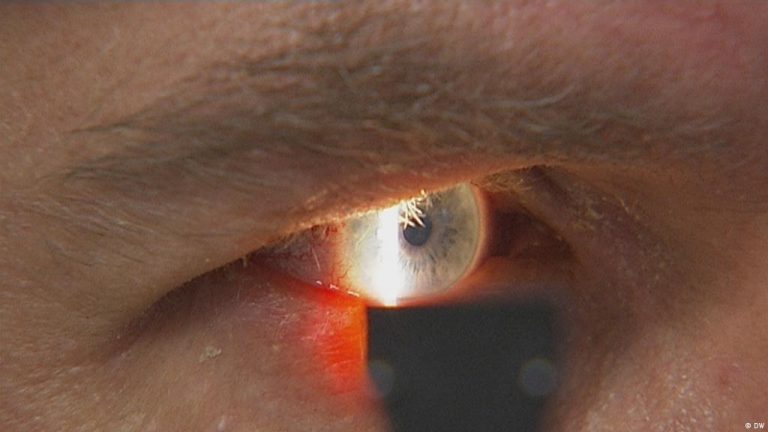 ملتحمة العين.. أحدث عوارض “أوميكرون”!