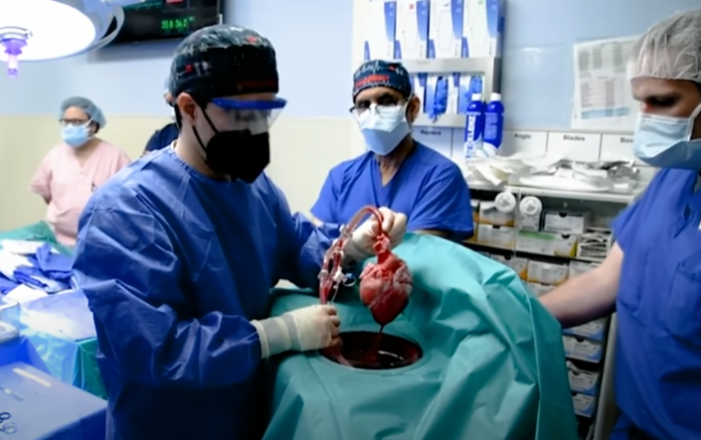 بالفيديو: لأول مرة.. نجاح زراعة قلب خنزير للإنسان!