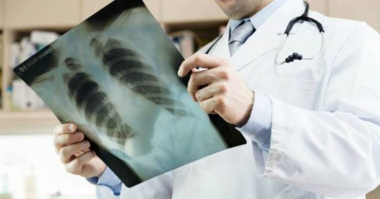 غذاء مفيد للرئتين.. اليكم ما هو