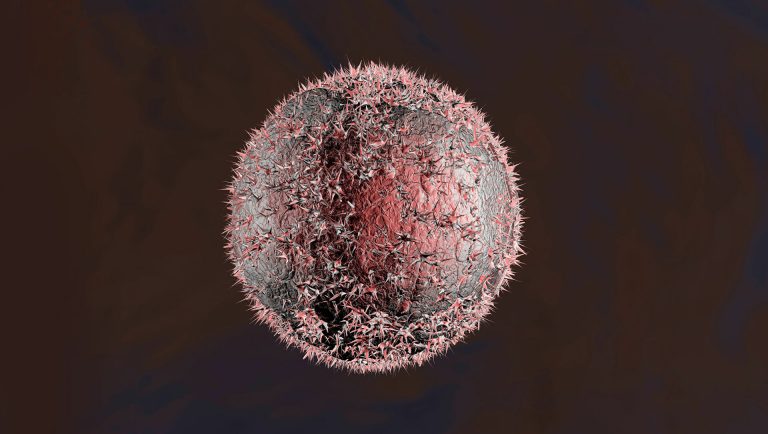 النظام الغذائي الغربي يعزز تطور سرطان الرئة