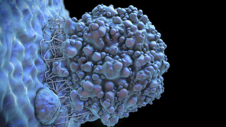 علامة في القدمين تشير إلى وجود ورم سرطاني!