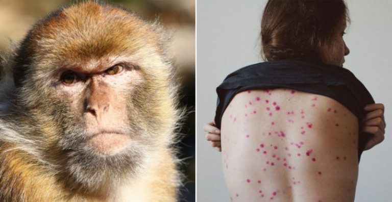 تحذير رسمي سبق تفشي “جدري القردة”؟