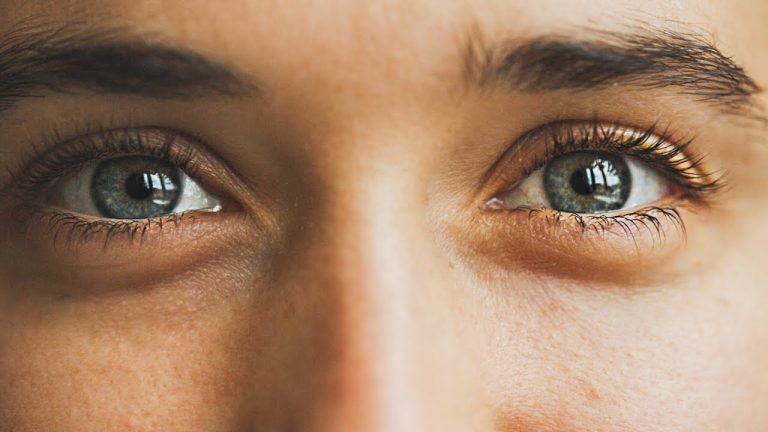 هذه أسباب ظهور الهالات السوداء.. ونصائح هامة لعلاجها!