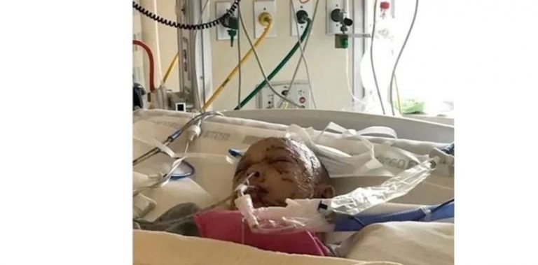 علقت بين فكّي الأسد.. ونجت بأعجوبة!