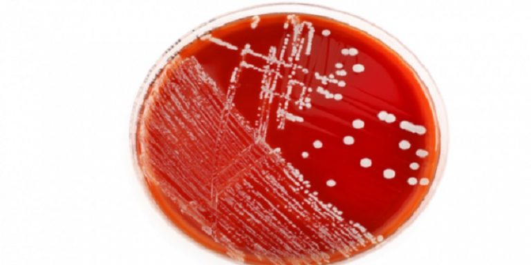 أكبر بكتيريا نادرة تحت مجهر العلماء!