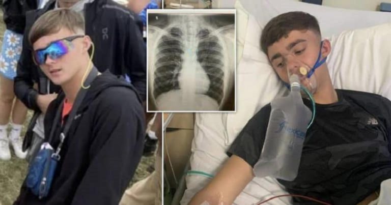 بريطاني “ينفجر” من الضحك!