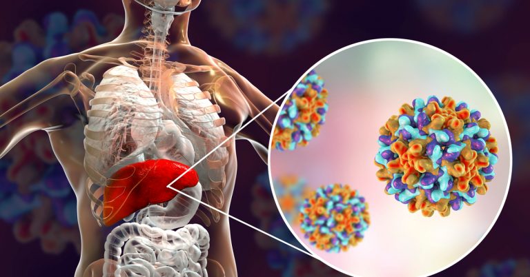555 إصابة “ريقان”: ما هي مناطق انتشاره وأعمار المصابين؟