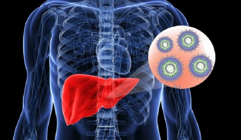 نقيب الأطباء: 118 إصابة بالتهاب الكبد الفيروسي