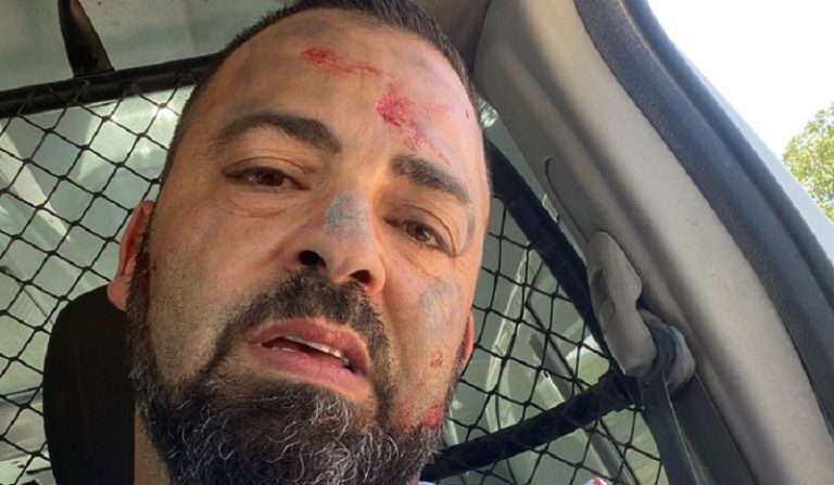 تعرض شاب لمحاولة قتل وسلب على يد 3 أشخاص