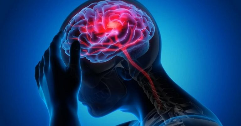 عادات تقلّل خطر الإصابة بسكتة دماغية