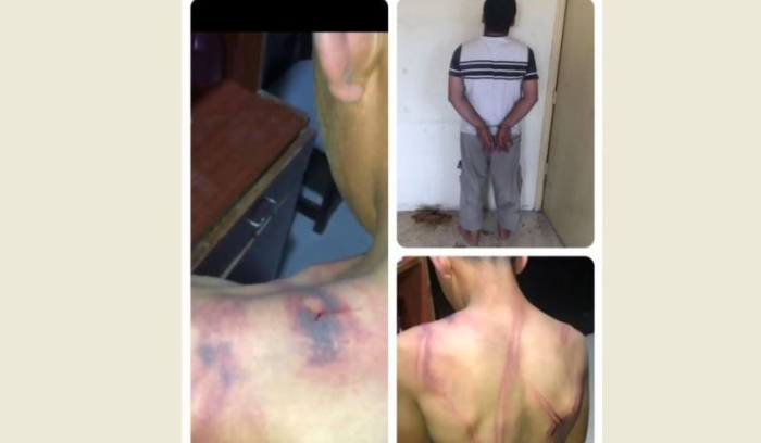 جلد إبنه القاصر بواسطة خرطوم