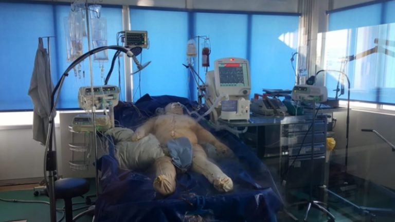 في طرابلس.. أضرم النار بزوجته لإرغامها على اجهاض جنينهما!