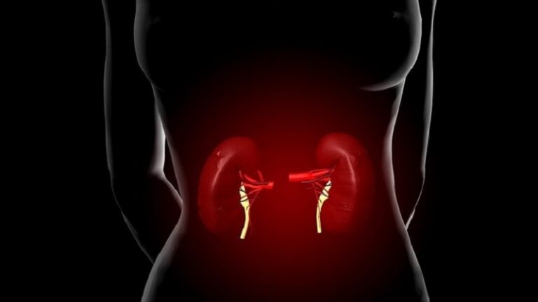 أنظمة غذائية تمنع تشكل الحصوات الكلوية