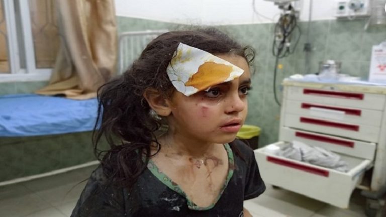 شـهـيـد و30 إصابة باستهداف منزل في رفح جنوبي غزة