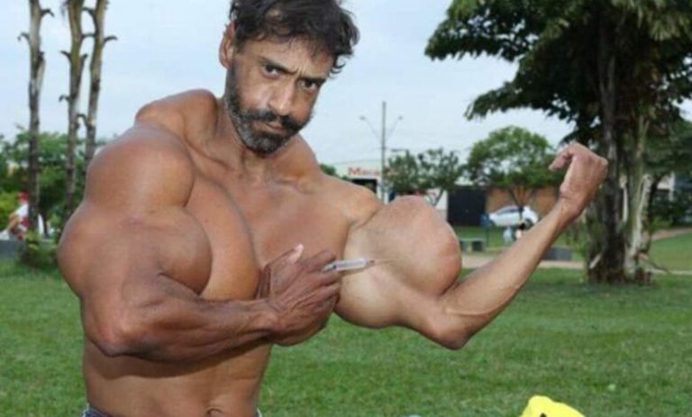 وفاة “العملاق الأخضر” البرازيلي بحقنة لتكبير العضلات