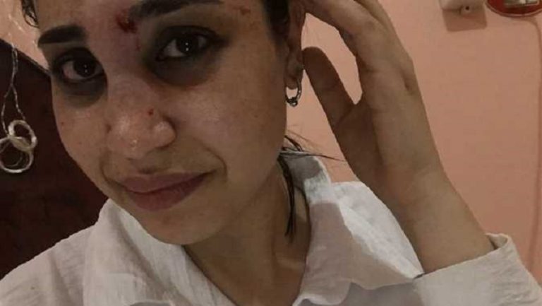 “قضية ريهام” في مصر تتفاعل: عنف أسري.. أم  “تأديب”؟