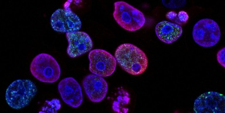 لقاح قريب للسرطان.. أطباء يترقبون “معجزة منتظرة”!