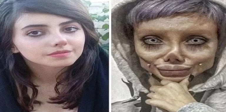 بعد ظهور صاعق.. “أنجلينا جولي إيران” تكشف سر وجه “الزومبي”