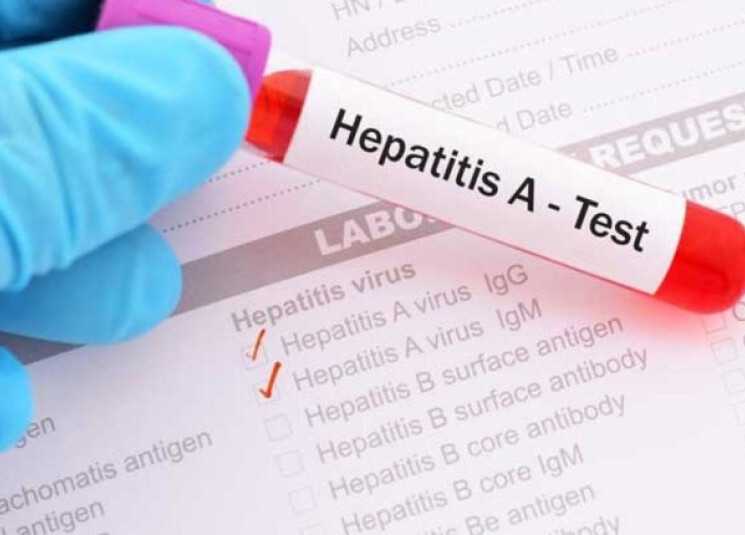 تحذير من التهاب الكبد الفيروسي في لبنان