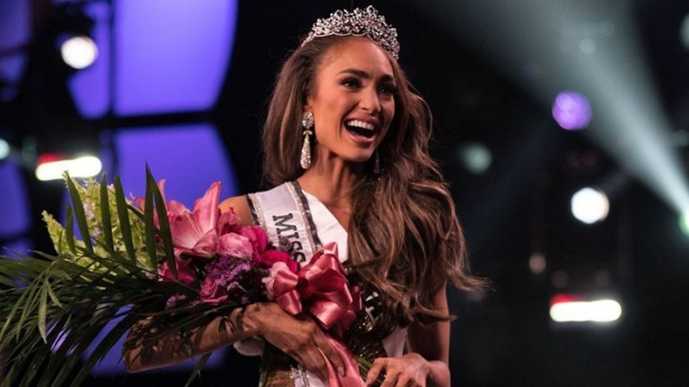 الكشف عن سر ملكة جمال الولايات المتحدة.. “خضعت لعدة عمليات تجميل”