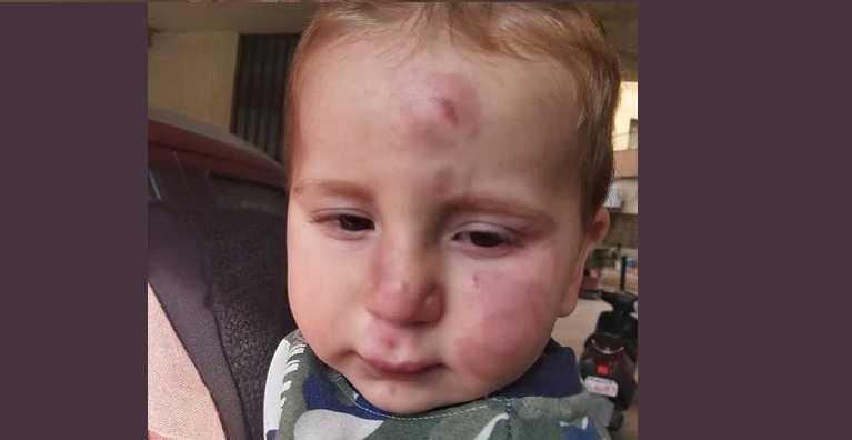 بعد تعرّض طفل للضرب المبرح.. إقفال دار حضانة في بشامون