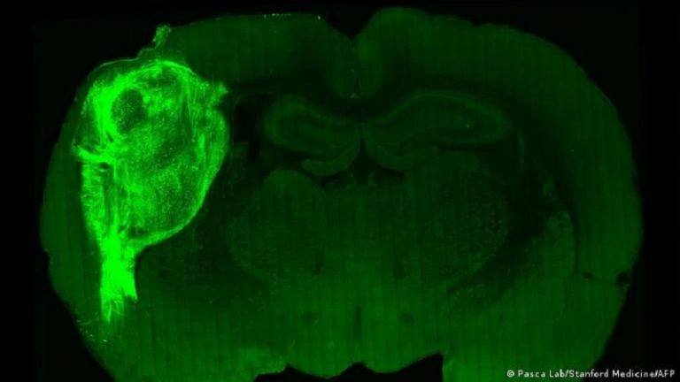 نجاح زراعة خلايا مخ بشري بمخ الفئران