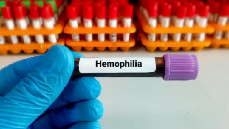 جرعته بـ3 مليون دولار.. ما هو أغلى دواء بالعالم؟