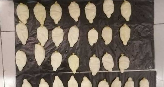 صور الأشعة فضحته.. ضبط 1.5 كيلوغرام كوكايين داخل أحشاء مسافر!