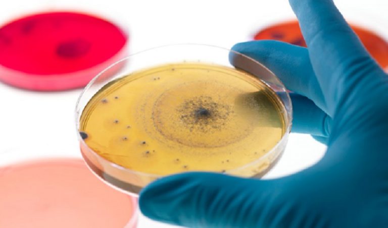 علماء يكتشفون “بكتيريا السعادة”