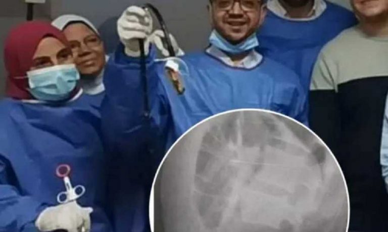 إبن الـ 20 يبتلع الهاتف لتهريبه.. وعملية جراحية لإستخراجه