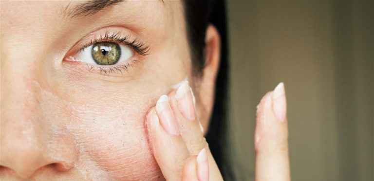 إلى السيدات.. ما الذي يؤكد أن بشرتك حساسة؟