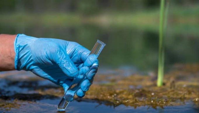 لا إصابات بالكوليرا في لبنان اليوم