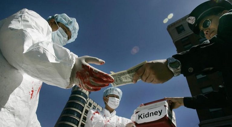 “تجارة أعضاء” الأسرى الروس في أوكرانيا!