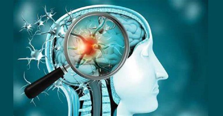 هل تغير كورونا وظيفة الدماغ؟