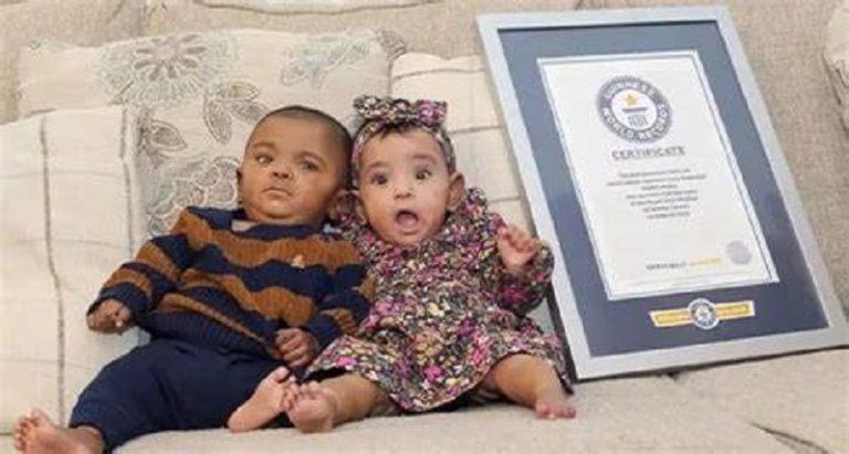 ولادة مبكرة