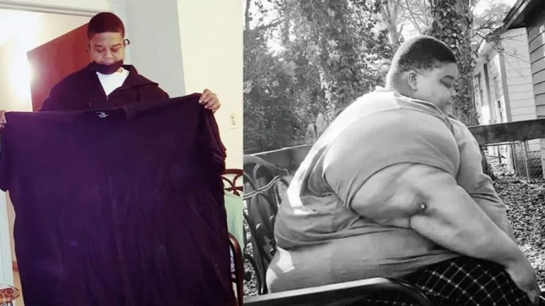 طبيب وصفه بـ “القنبلة الموقوتة”.. أميركي يخسر 165 كيلو من وزنه