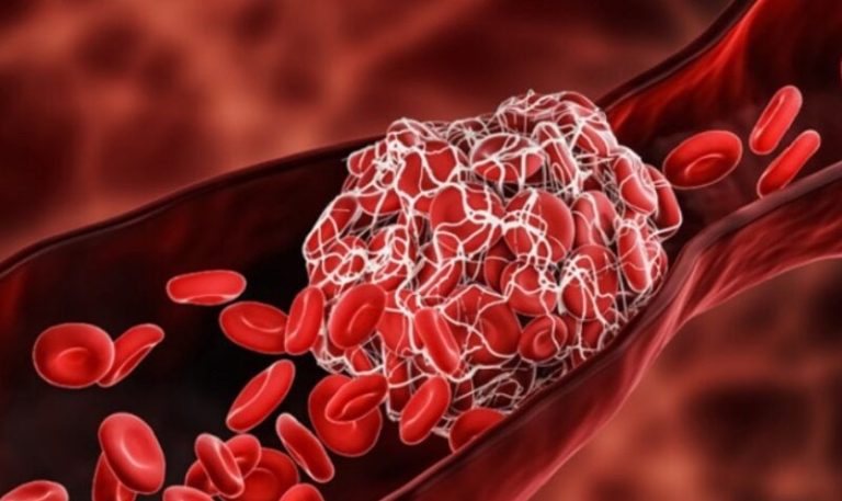 مشروبات تنقذ من تجلط الدم