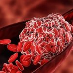 blood-800×549
