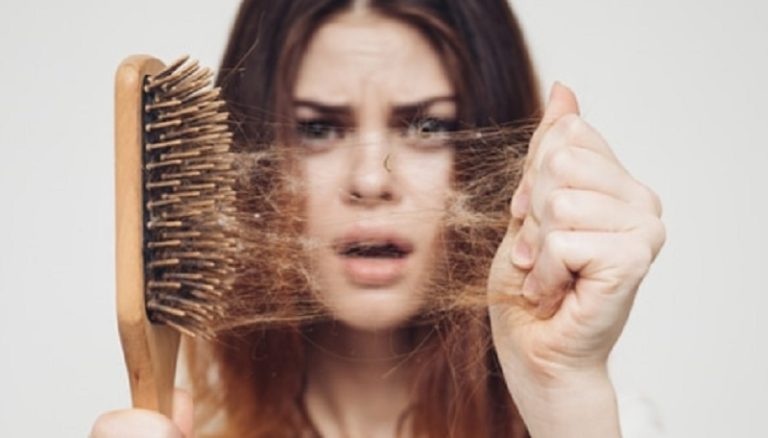 تساقط الشعر
