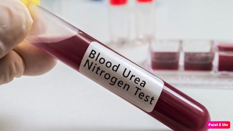 مكون أساسي في البول.. ما علاقة ارتفاعه بمرض الكلى؟