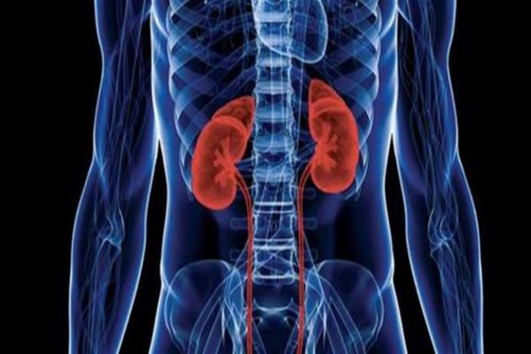 نقصان إنزيم رئيسي في الجسم يسبب أمراض الكلى