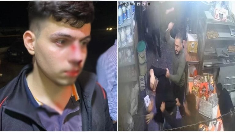 المعيصرة اشكال