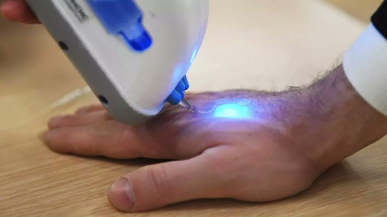 بالصور: ابتكار “مسدس نسيج” لخياطة الجروح