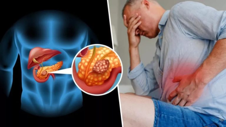 سرطان البنكرياس أو “القاتل الصامت”.. هل من عوارض واضحة؟