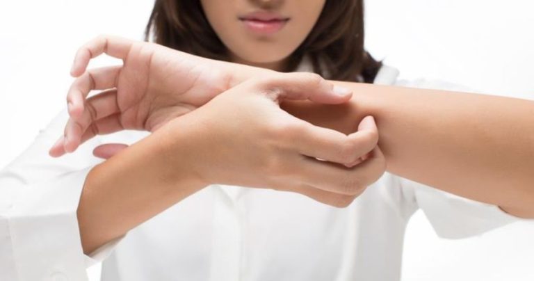 خل التفاح.. علاج منزلي “سحري” للتخفيف من الحكة!