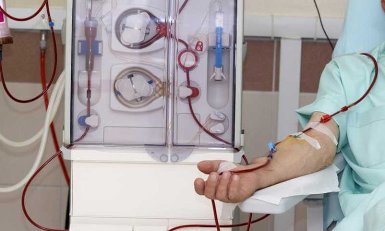 تسعيرة جديدة لجلسة غسيل الكلى